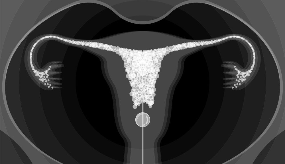 hsg x-ray